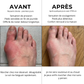 Vos pieds souffrent en silence - voici la solution anti-froid & anti-douleur.