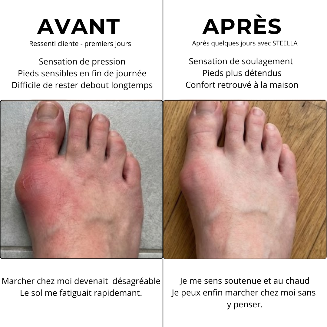 Vos pieds souffrent en silence - voici la solution anti-froid & anti-douleur.